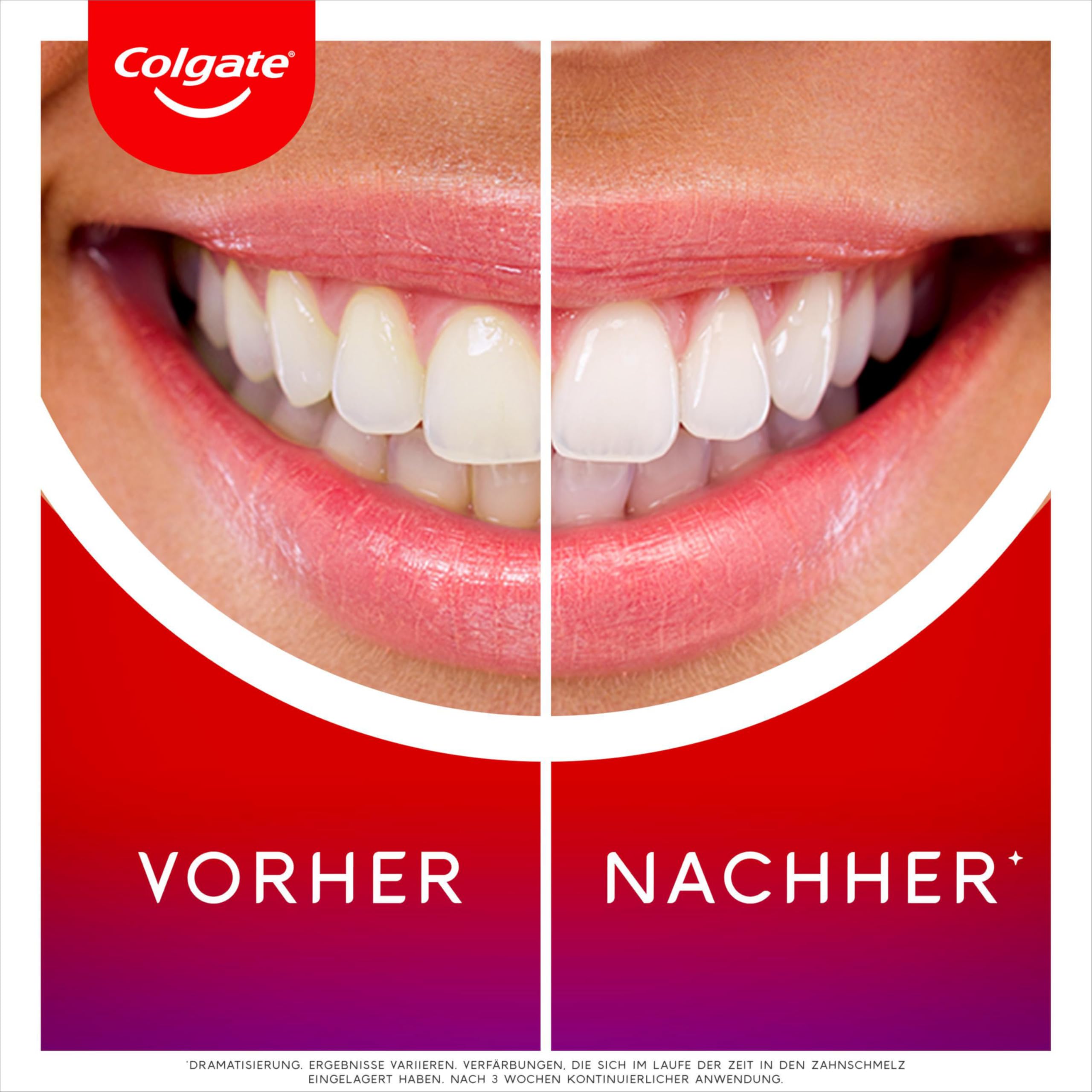 colgate-max-white-led-whitening-kit-zahnaufhellung-10-min image 3