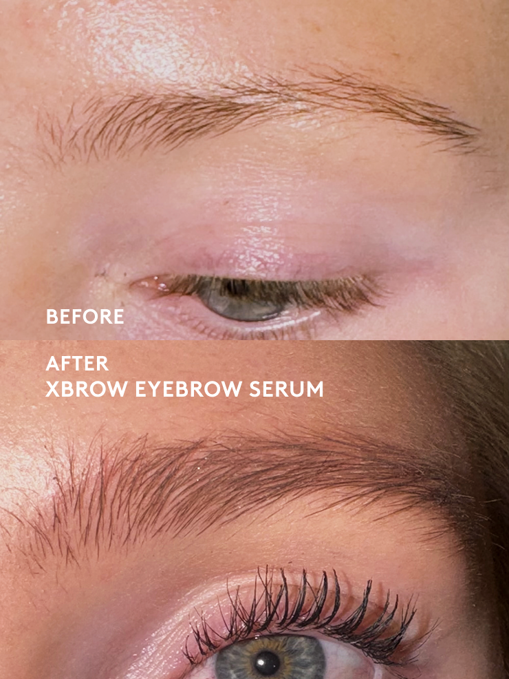 xlash-xlash-xbrow-kit-wimpernserum-brauenserum-set image 6