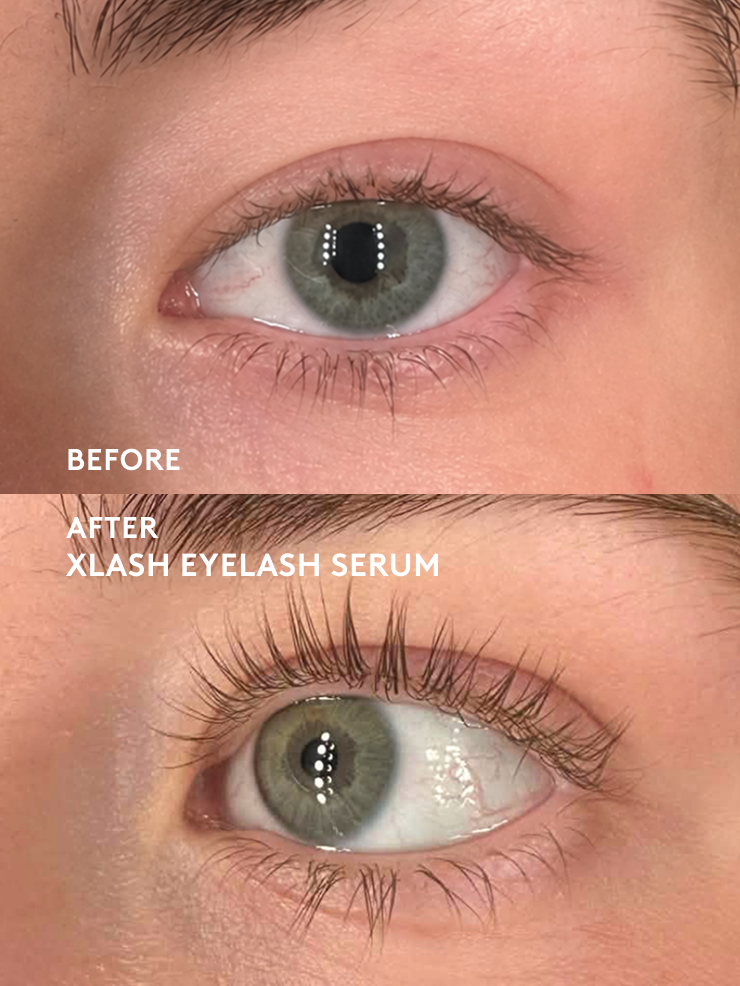 xlash-eyelash-brow-serums-wimpernserum-5ml-biotin image 3