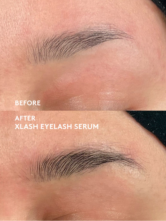 xlash-kits-grow-boost-brow-kit-augenbrauenset-soft-brown image 5