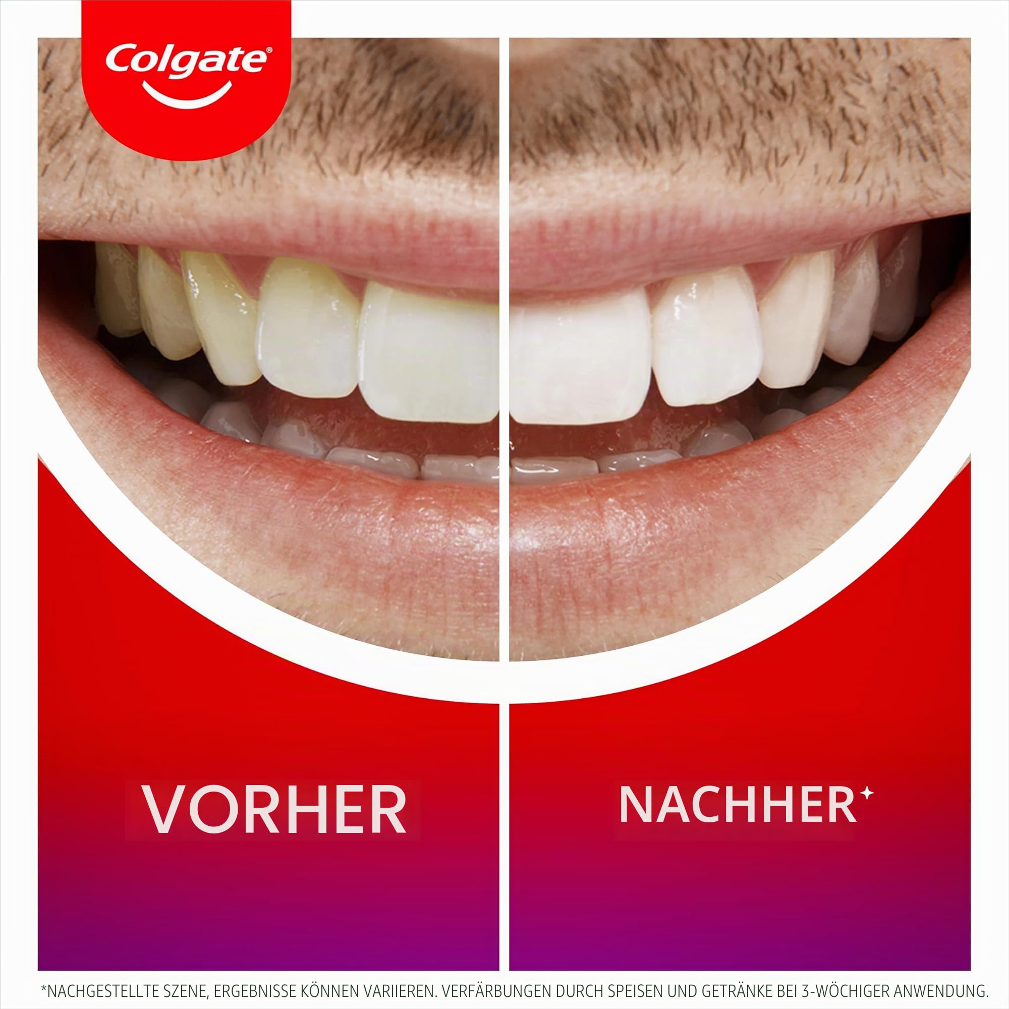 colgate-max-white-zahnaufhellungs-set-zahnpasta-serum-ultra image 4