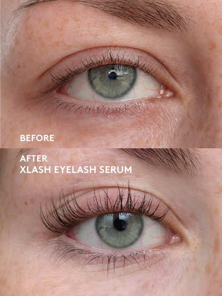 xlash-evening-routine-kit-wimpernserum-augenpads-nacht image 4