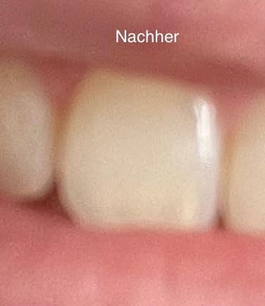 Frische