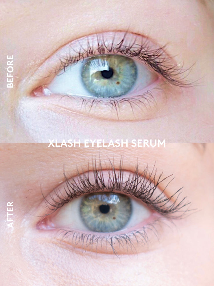 xlash-grow-define-lash-kit-wimpernserum-set-primer image 3