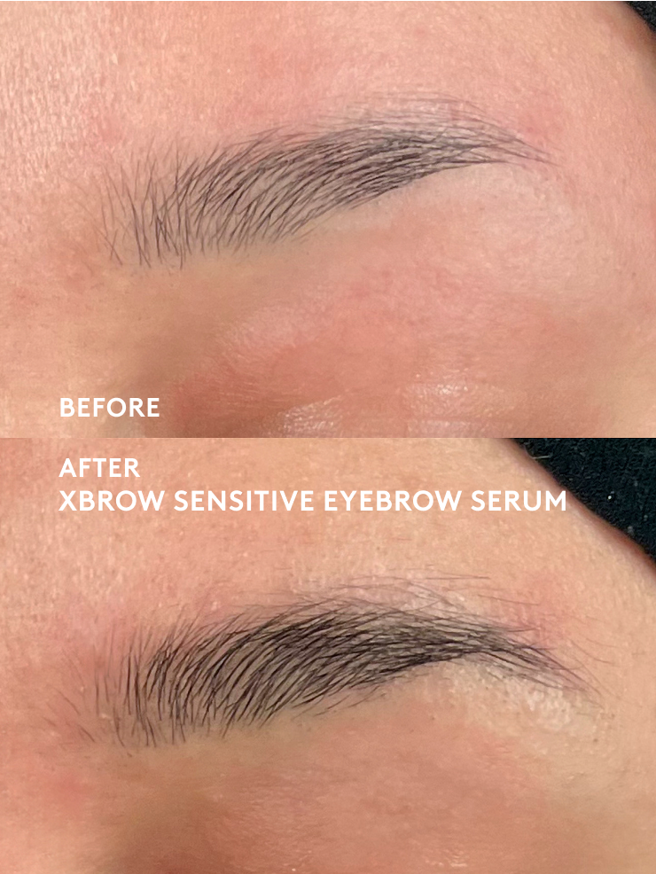 xlash-xbrow-sensitive-augenbrauenserum-3ml-vegan image 3