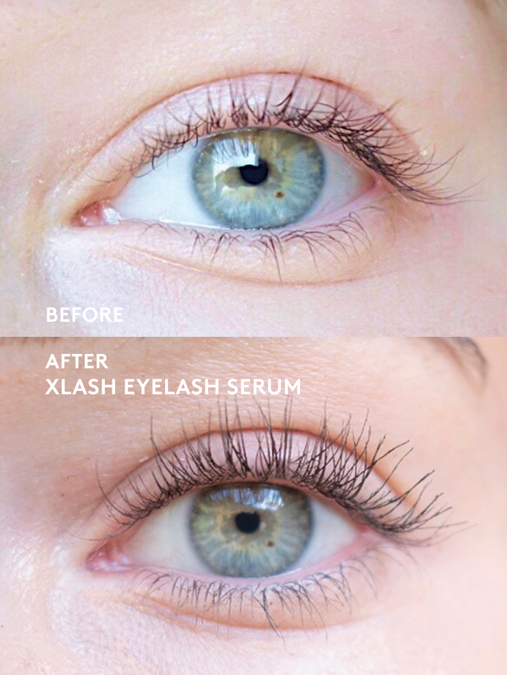 xlash-kits-eyeconic-bestseller-kit-wimpernserum-eye-gels image 2