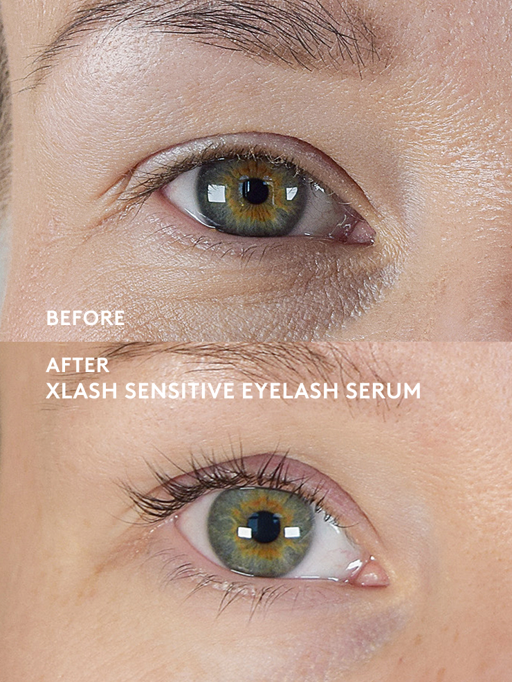 xlash-sensitive-wimpernserum-3ml-peptide-ohne-prostaglandin image 3