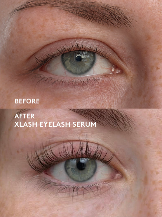 xlash-grow-boost-lash-kit-wimpernserum-set-mit-mascara image 6