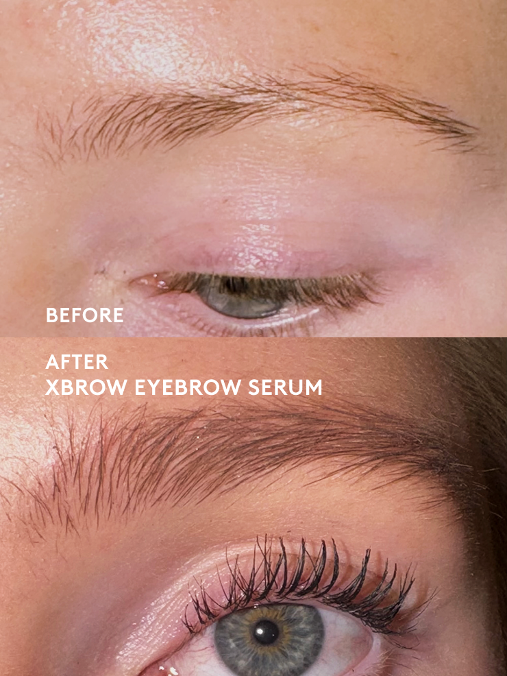 xbrow-xlash-augenbrauenserum-1-5ml-biotin-dichte image 3